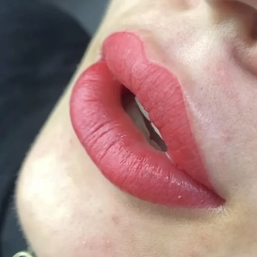 Resultat candy lips maquillage permanent